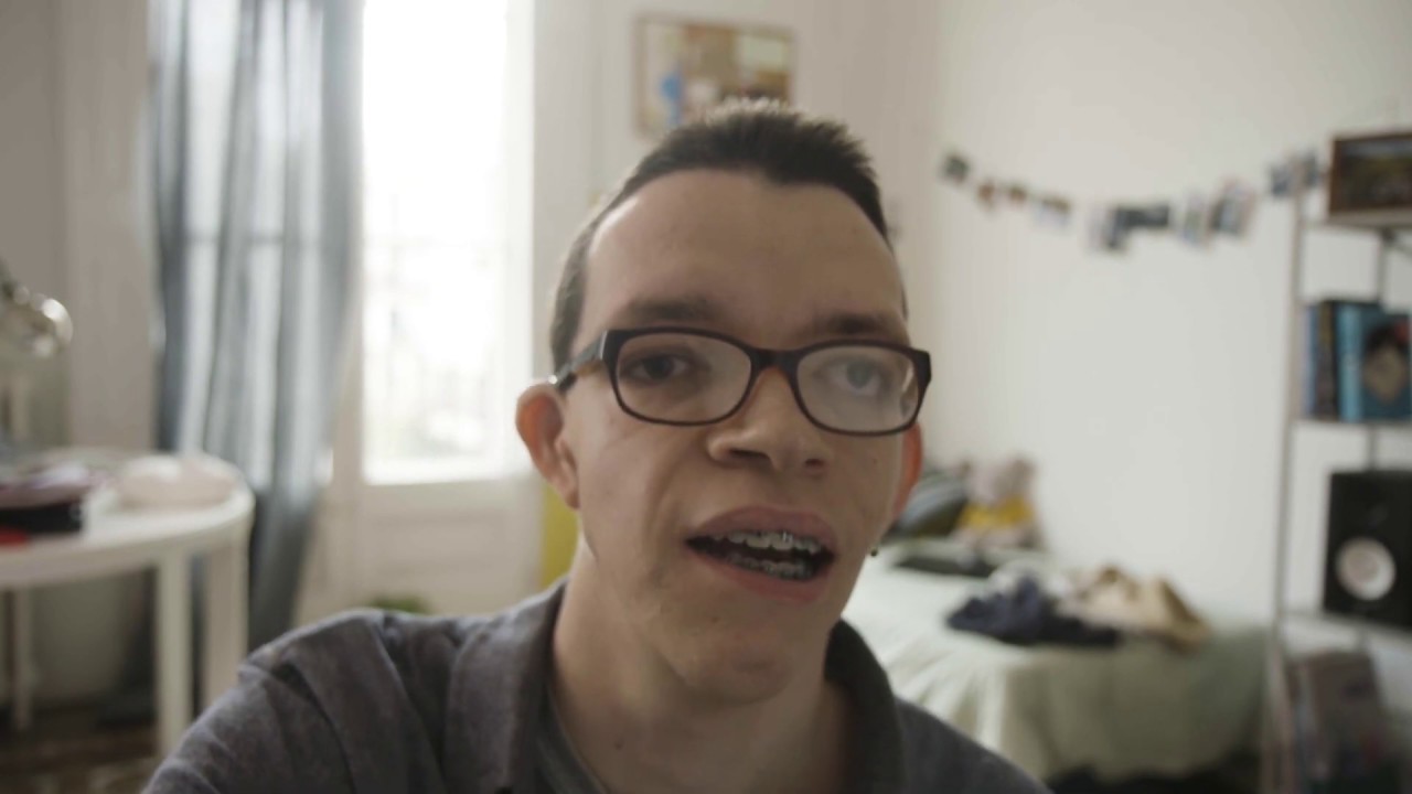 No es cómo eres, sino quién eres - Asociación Nacional Treacher Collins